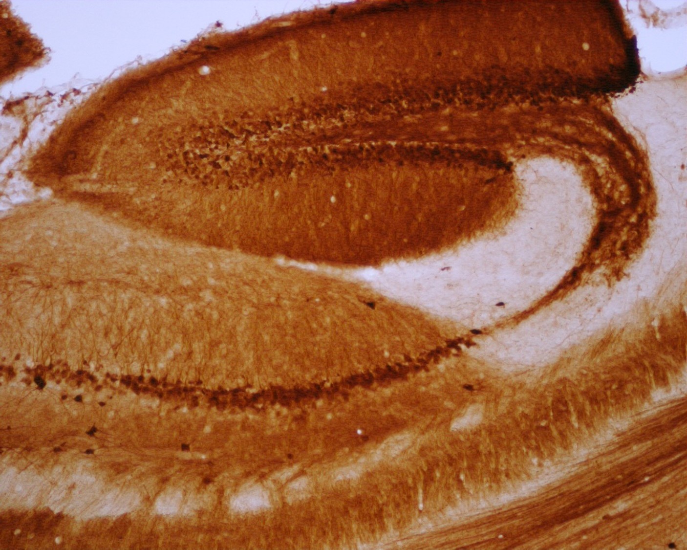 CB300 - Calbindin-500uL