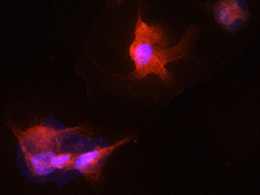 Neuromics 한국공식대리점